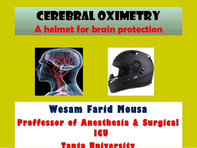 Brain Protection in Cardiac Surgery